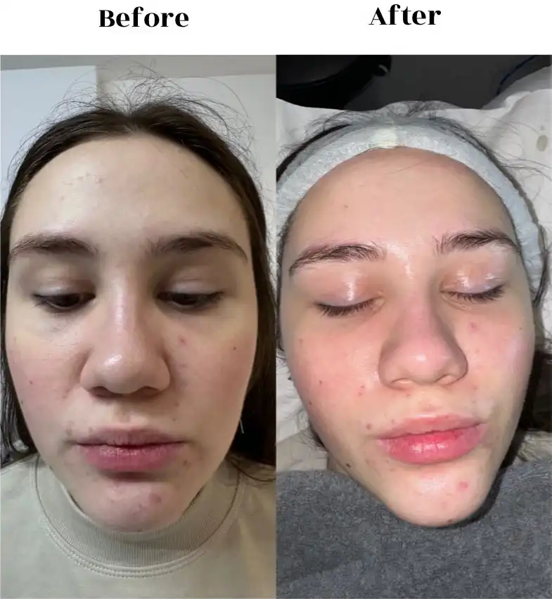 before after 1
