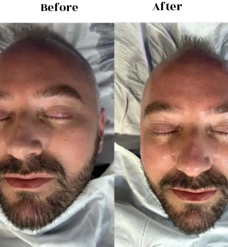 before after 2
