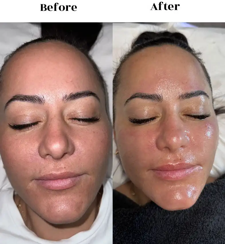 before after 3